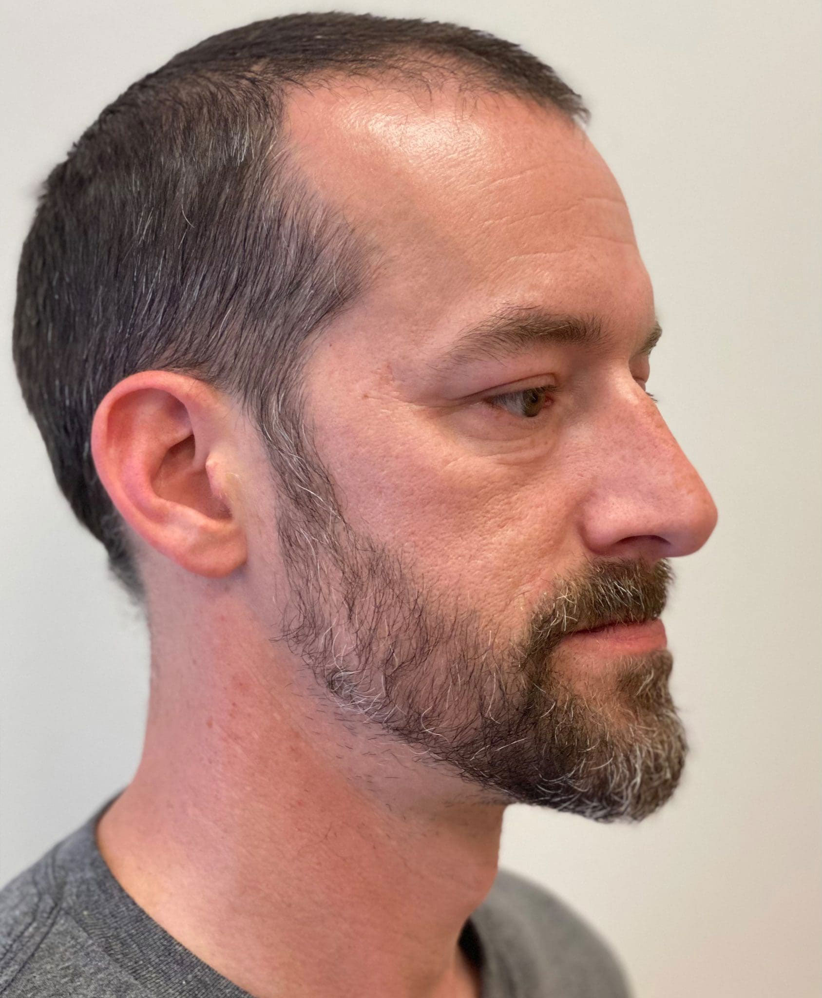 The image shows a man with a beard and a mustache, wearing a gray shirt, looking directly at the camera.
