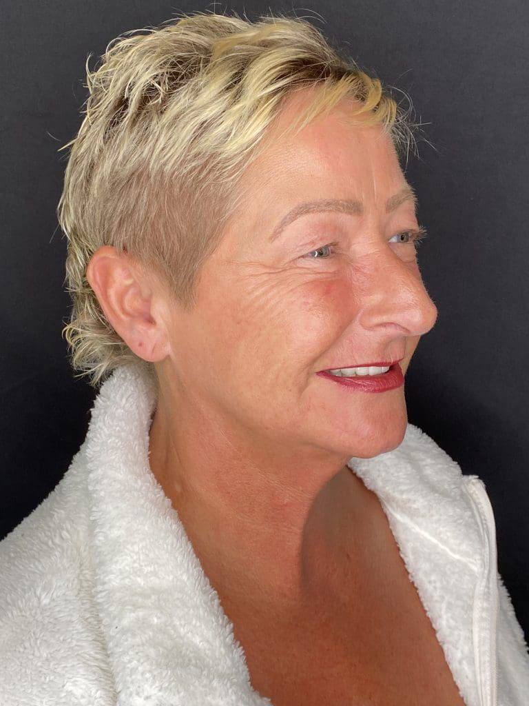 An elderly woman with short hair and a slight smile, wearing a white top.