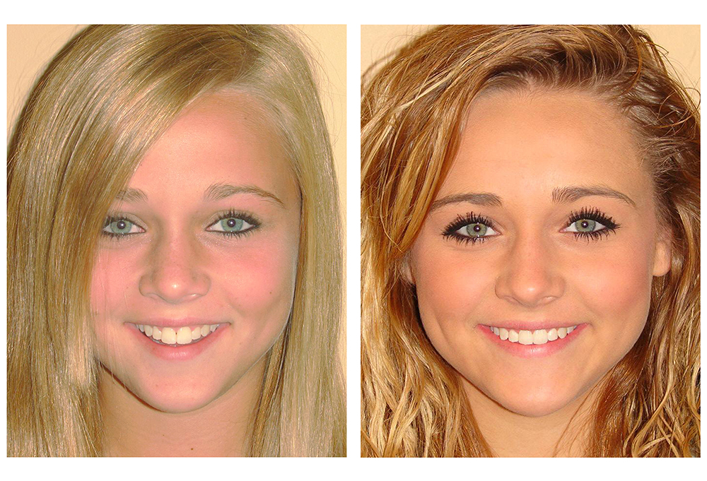 Newpoint Family Dental