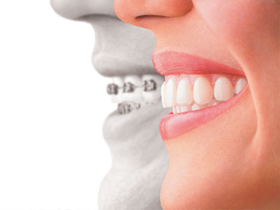 An advertisement featuring a smiling woman with a focus on dental health, showcasing a toothy smile and an image of a healthy mouth with visible teeth and gums.