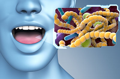 The image features a 3D rendering of a human face with an open mouth, positioned in front of a microscopic view of bacteria.