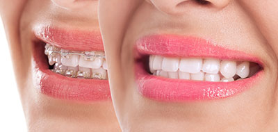 A close-up of a smiling woman with pink lipstick, showcasing her teeth and lips.