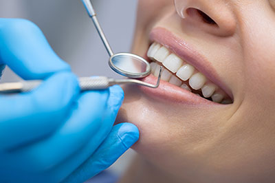 A dental professional performing a teeth cleaning procedure on a patient.