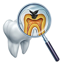 An illustration of a magnified tooth with an open crown and a visible pulp chamber, viewed through a magnifying glass, with an overlay of an X-ray image showing the tooth s internal structure.