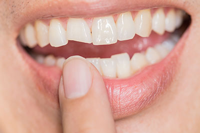 A person with a toothy smile holding their finger in front of their mouth.