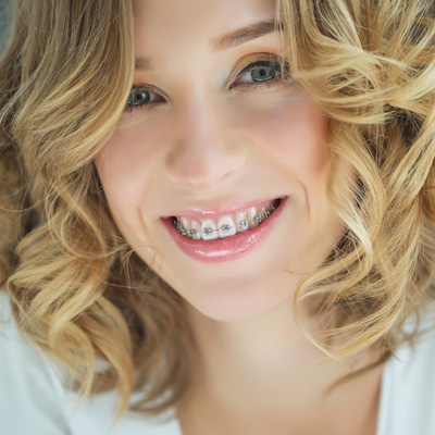The image features a woman with a straight, bright smile against a light background, showcasing her braces and white teeth.