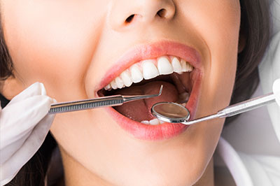 A woman with a wide smile has her teeth cleaned by a dental hygienist using a drill, with visible dental instruments and a cup of water in the background.