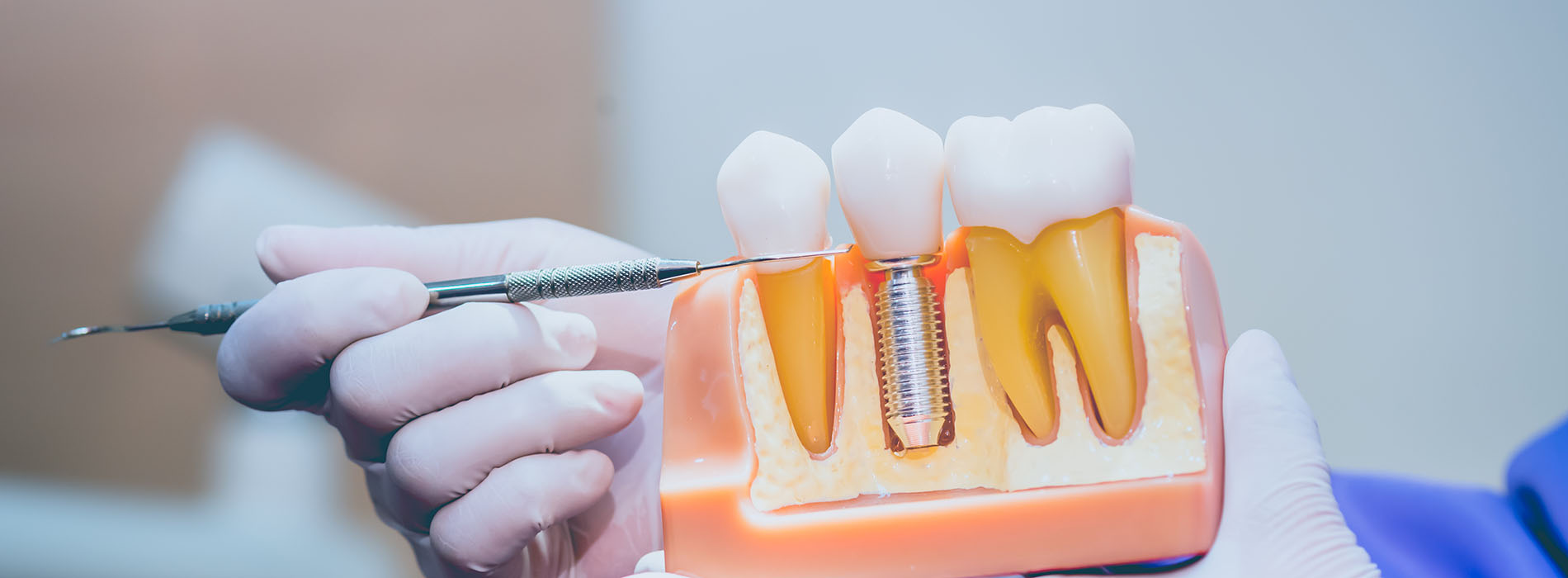 A person s hand holding a toothbrush with bristles over an open mouth model, likely for dental hygiene demonstration.