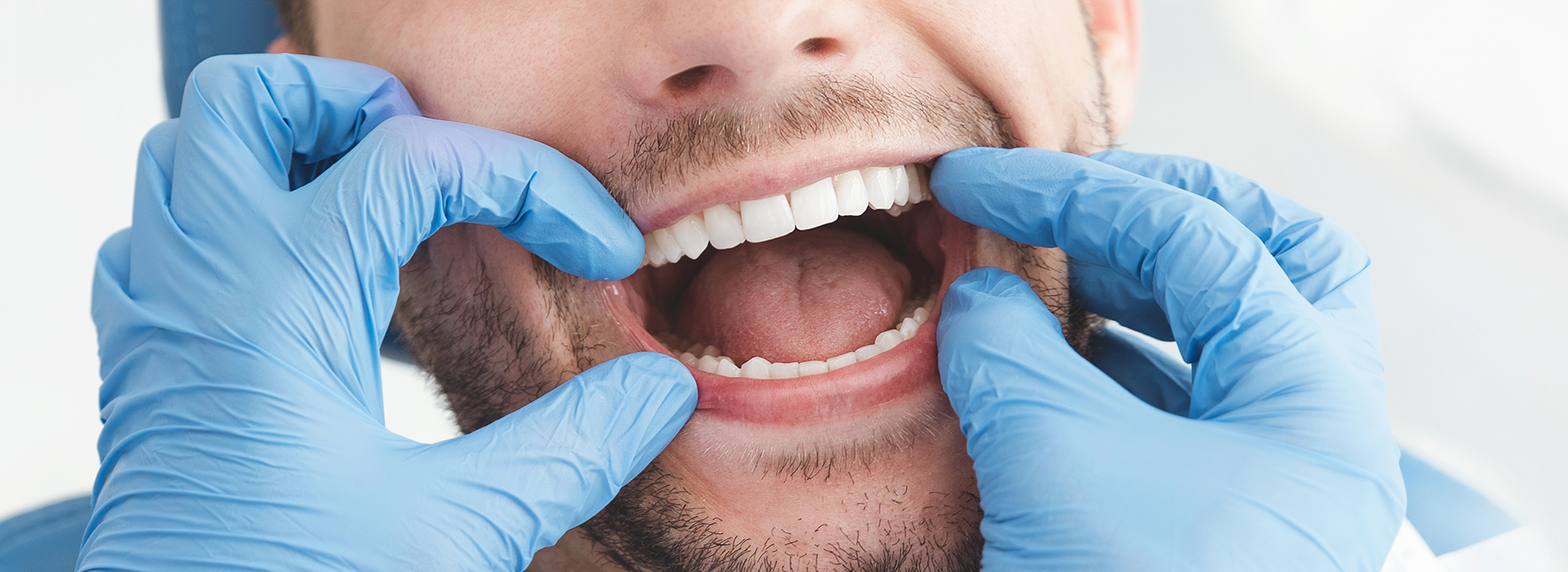 A man in a medical setting with his mouth open, wearing a surgical mask and gloves.