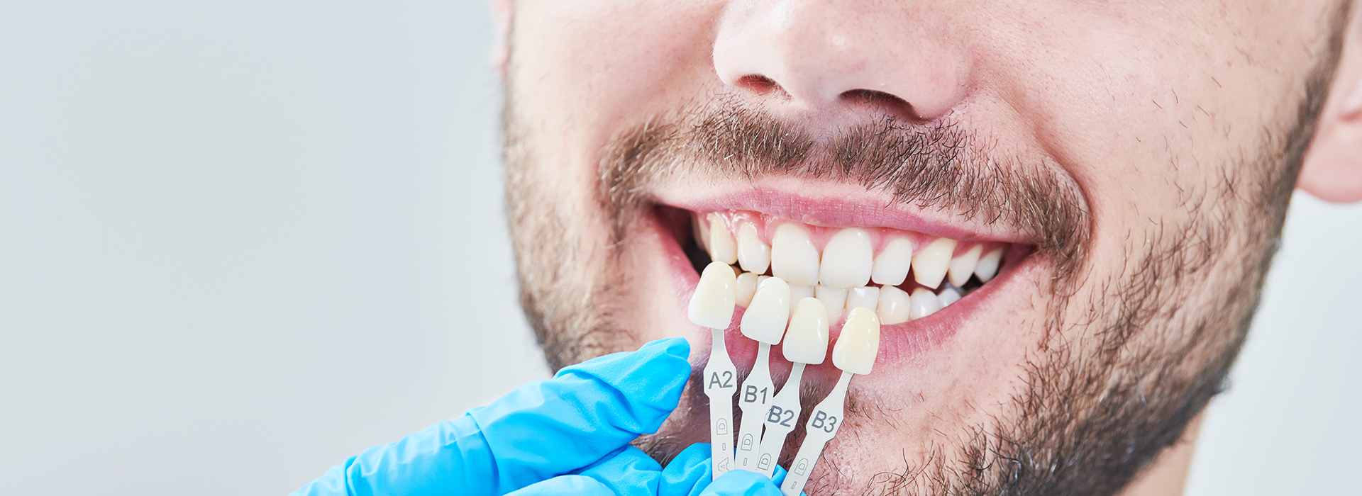 The image shows a man with a smile, wearing a blue surgical mask and holding dental implants in his hand.