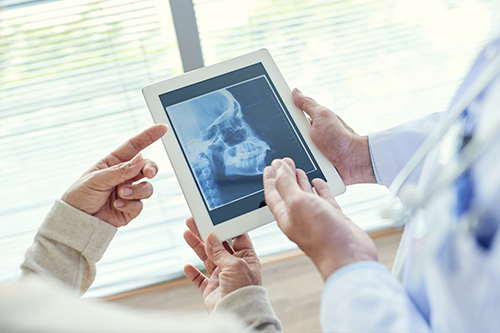 Newpoint Family Dental | Ceramic Crowns, Dental Bridges and All-on-6 reg